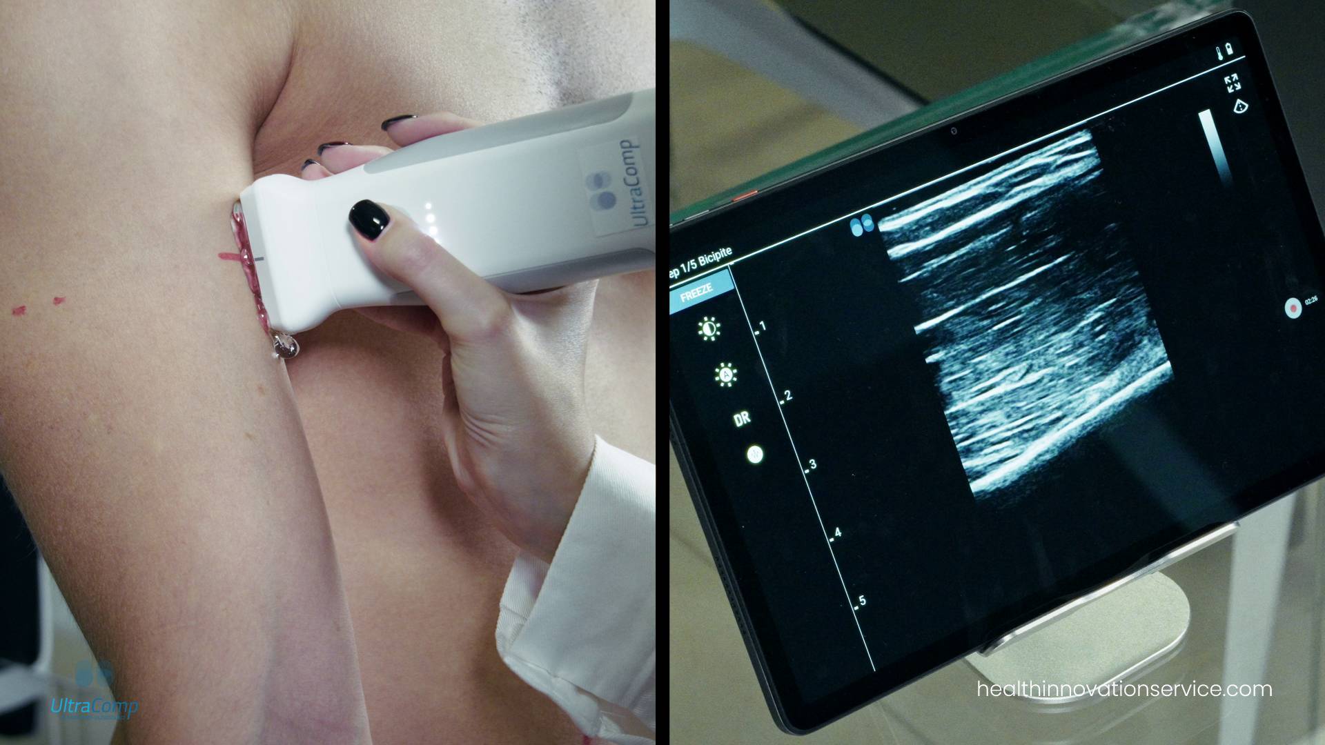 Health Innovation Service Ultracomp ONE Probe
